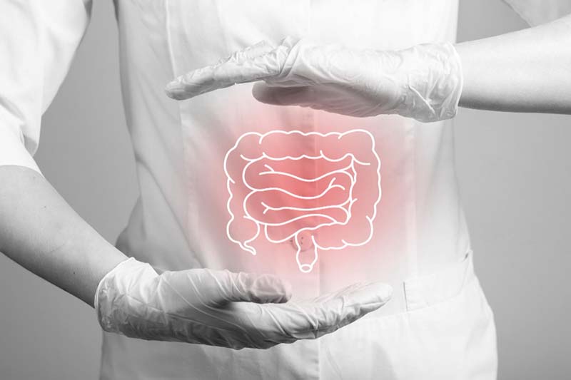 Como fortalecer a microbiota intestinal: passo a passo!